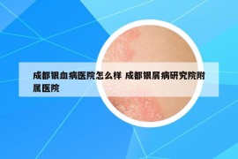 成都银血病医院怎么样 成都银屑病研究院附属医院