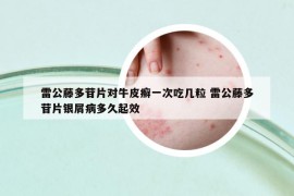 雷公藤多苷片对牛皮癣一次吃几粒 雷公藤多苷片银屑病多久起效