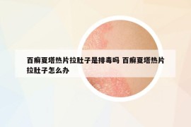 百癣夏塔热片拉肚子是排毒吗 百癣夏塔热片拉肚子怎么办