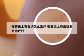 嘴唇边上有白块怎么治疗 嘴唇边上有白块怎么治疗好