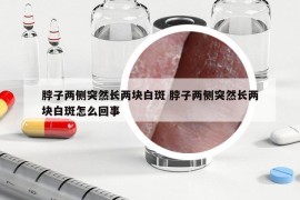 脖子两侧突然长两块白斑 脖子两侧突然长两块白斑怎么回事