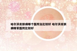 哈尔滨皮肤病哪个医院治比较好 哈尔滨皮肤病哪家医院比较好