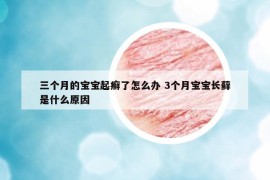 三个月的宝宝起癣了怎么办 3个月宝宝长藓是什么原因