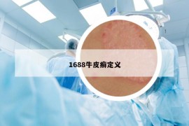 1688牛皮癣定义