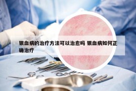 银血病的治疗方法可以治愈吗 银血病如何正确治疗