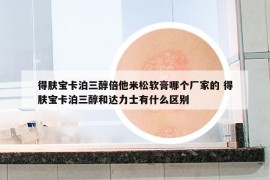 得肤宝卡泊三醇倍他米松软膏哪个厂家的 得肤宝卡泊三醇和达力士有什么区别