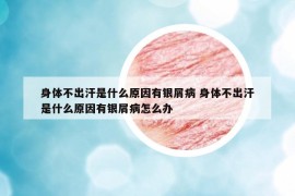 身体不出汗是什么原因有银屑病 身体不出汗是什么原因有银屑病怎么办