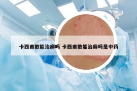 卡西甫散能治癣吗 卡西甫散能治癣吗是中药