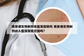 银屑病生物制剂有医保报销吗 银屑病生物制剂纳入医保报销范围吗?