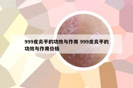 999皮炎平的功效与作用 999皮炎平的功效与作用价格