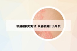 银屑病抗敏疗法 银屑病用什么单抗