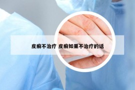 皮癣不治疗 皮癣如果不治疗的话