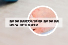 南京市皮肤病研究所门诊时间 南京市皮肤病研究所门诊时间 肤康电话