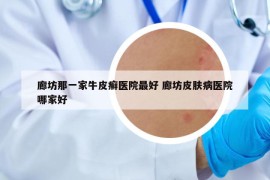 廊坊那一家牛皮癣医院最好 廊坊皮肤病医院哪家好