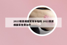 2023银屑病国家有补贴吗 2021银屑病国家免费治疗