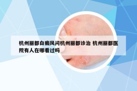 杭州丽都白癜风问杭州丽都诊治 杭州丽都医院有人在哪看过吗