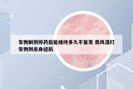 生物制剂停药后能维持多久不复发 类风湿打生物剂亲身经历