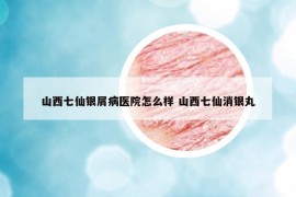 山西七仙银屑病医院怎么样 山西七仙消银丸