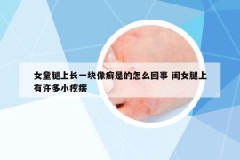 女童腿上长一块像癣是的怎么回事 闺女腿上有许多小疙瘩