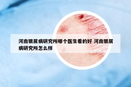 河南银屑病研究所哪个医生看的好 河南银屑病研究所怎么样