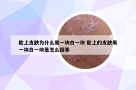 脸上皮肤为什么黑一块白一块 脸上的皮肤黑一块白一块是怎么回事