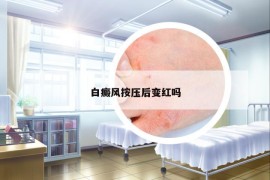 白癜风按压后变红吗