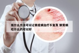 有什么方法可以让银痃病治疗不复发 银霄病吃什么药可以好