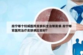 南宁哪个权威医院皮肤科主治银屑病 南宁哪家医院治疗皮肤病比较好?