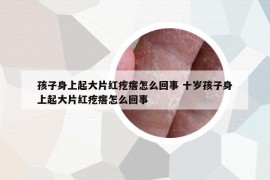 孩子身上起大片红疙瘩怎么回事 十岁孩子身上起大片红疙瘩怎么回事