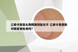 辽癣卡西普丸期限刚到能吃不 辽癣卡普西散对银屑病有用吗?