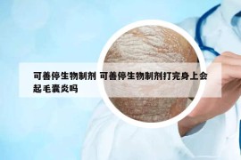 可善停生物制剂 可善停生物制剂打完身上会起毛囊炎吗