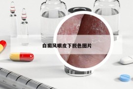 白癜风眼皮下脱色图片