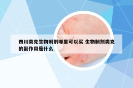 四川类克生物制剂哪里可以买 生物制剂类克的副作用是什么