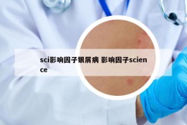 sci影响因子银屑病 影响因子science