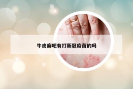 牛皮癣吧有打新冠疫苗的吗