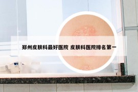 郑州皮肤科最好医院 皮肤科医院排名第一