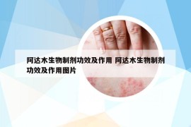 阿达木生物制剂功效及作用 阿达木生物制剂功效及作用图片