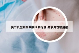 关节炎型银屑病的诊断标准 关节炎性银屑病