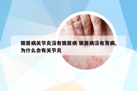 银屑病关节炎没有银屑病 银屑病没有发病,为什么会有关节炎