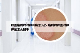 膝盖胳膊肘对称有癣怎么办 胳膊肘膝盖对称痒是怎么回事