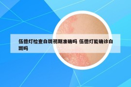 伍德灯检查白斑初期准确吗 伍德灯能确诊白斑吗