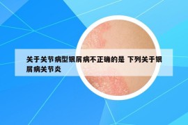 关于关节病型银屑病不正确的是 下列关于银屑病关节炎