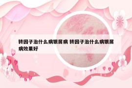 转因子治什么病银屑病 转因子治什么病银屑病效果好