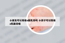 小朋友可以用维a酸乳膏吗 小孩子可以擦维a乳酸膏嘛