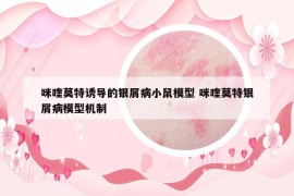 咪喹莫特诱导的银屑病小鼠模型 咪喹莫特银屑病模型机制