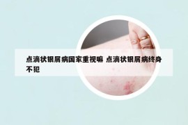 点滴状银屑病国家重视嘛 点滴状银屑病终身不犯