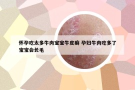 怀孕吃太多牛肉宝宝牛皮癣 孕妇牛肉吃多了宝宝会长毛