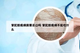 掌跎脓疱病需要忌口吗 掌跎脓疱病不能吃什么