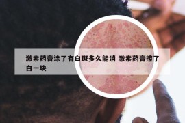 激素药膏涂了有白斑多久能消 激素药膏擦了白一块