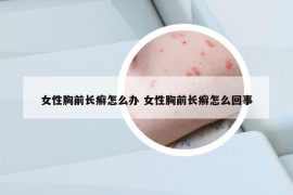 女性胸前长癣怎么办 女性胸前长癣怎么回事